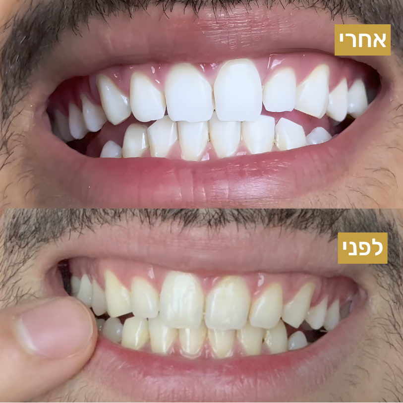 משחה לשימור ההלבנה
