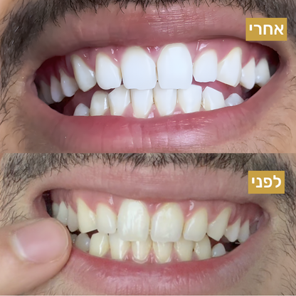 משחה לשימור ההלבנה